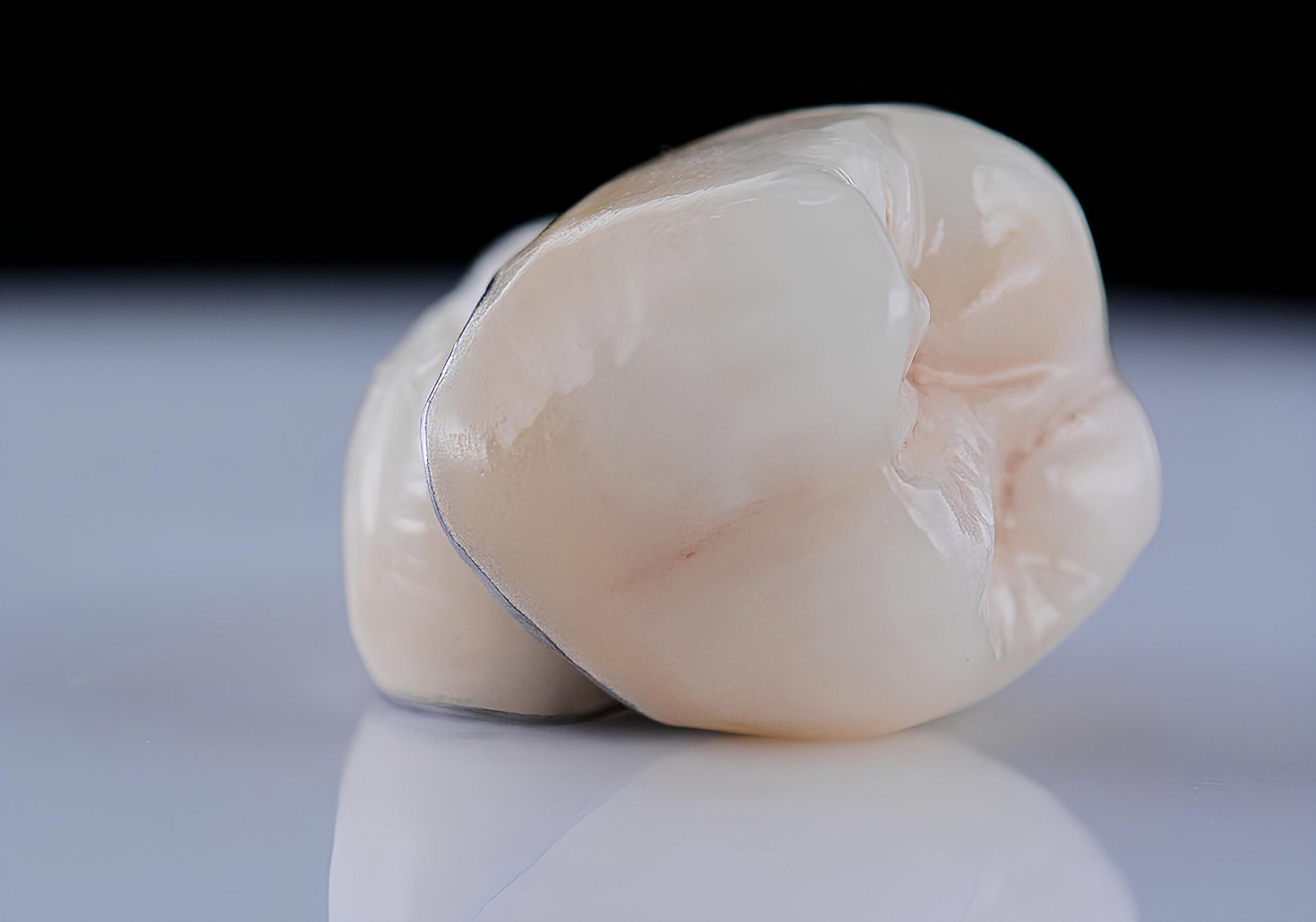 zoomed in porcelain dental crown
