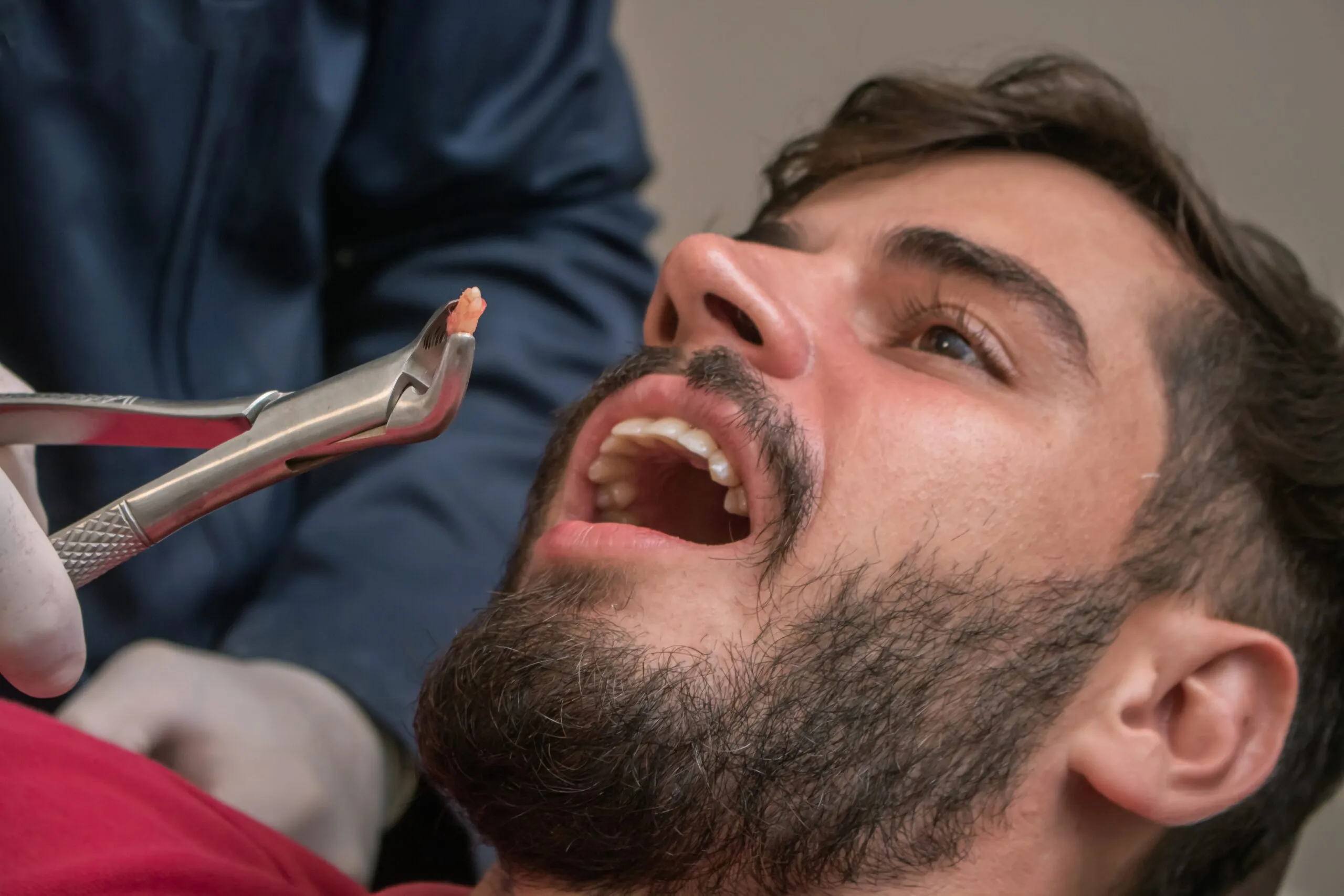 young man having a tooth extracted in Bloomington