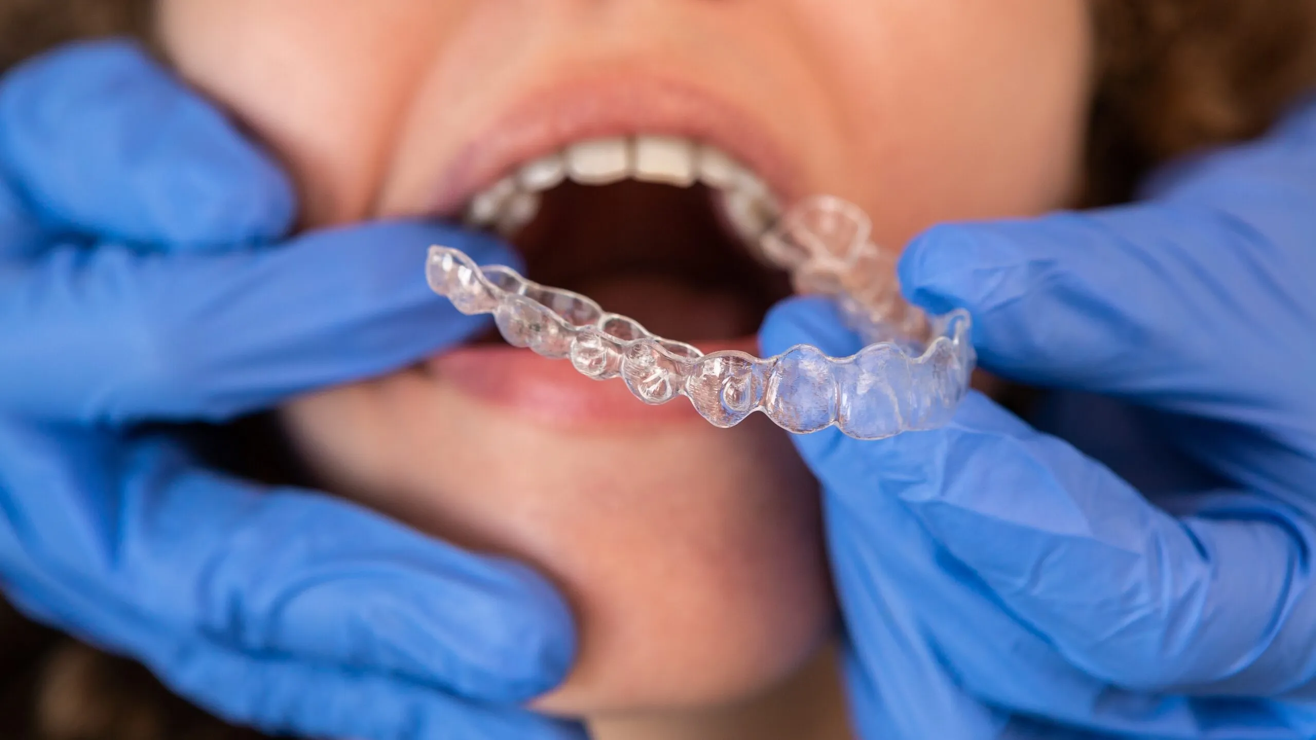 dentist placing a female patients Invisalign in her mouth