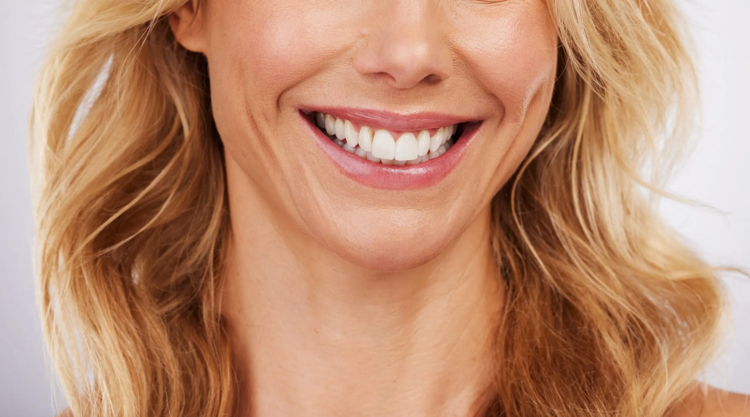 Closeup, smile and woman with new veneers